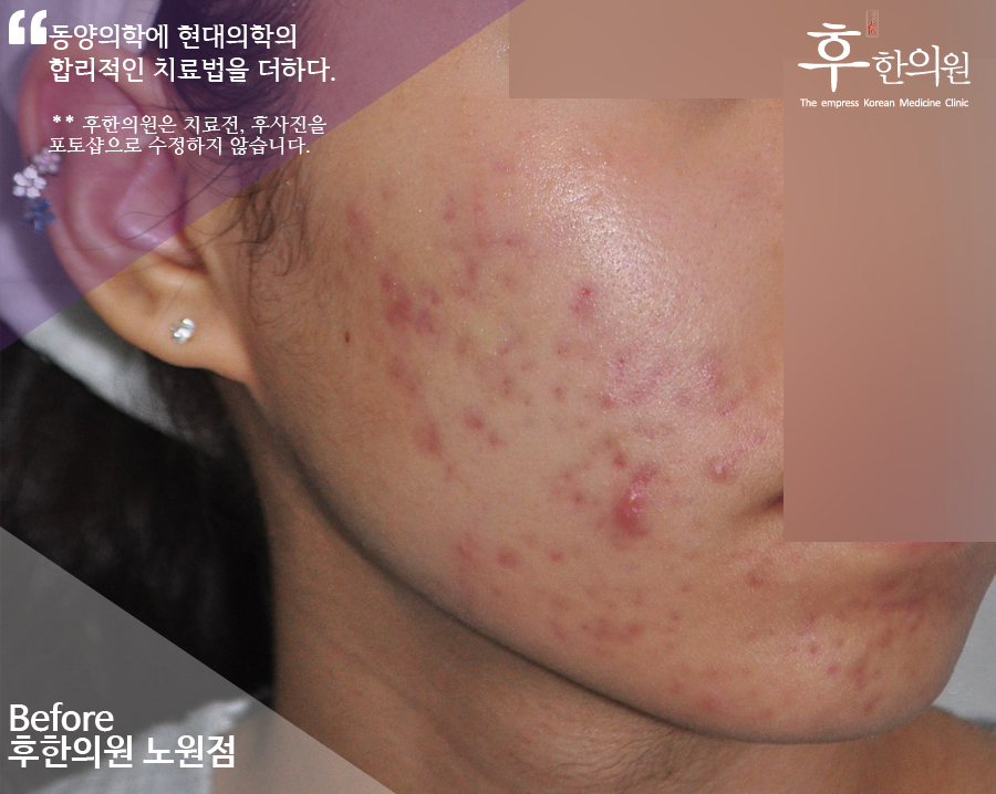 전후사진