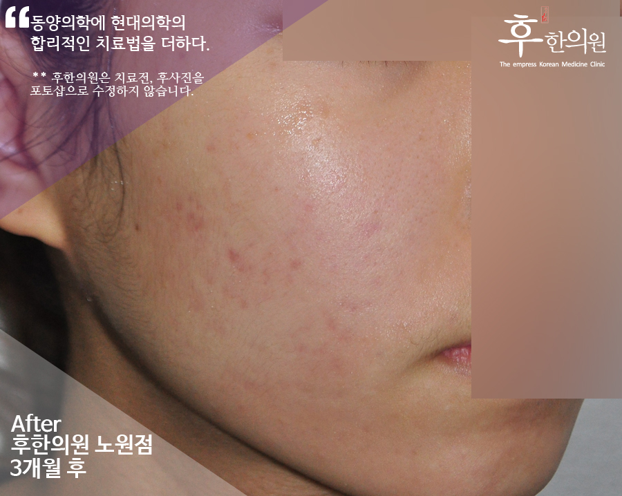 전후사진