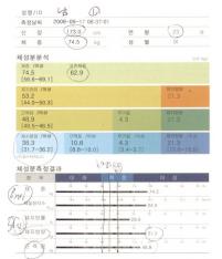 전후사진