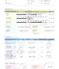 전후사진