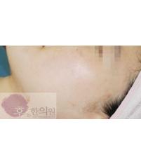 전후사진