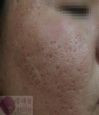 전후사진