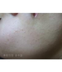 전후사진
