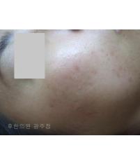 전후사진