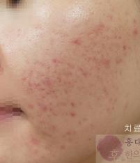 전후사진
