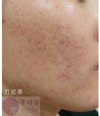 전후사진