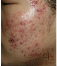 전후사진