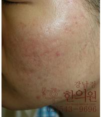 전후사진