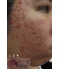 전후사진