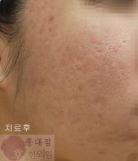전후사진