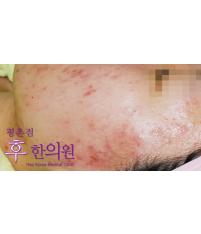 전후사진