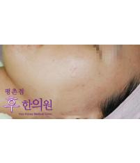 전후사진