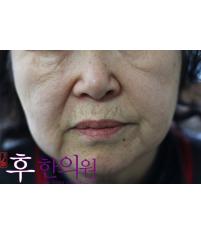 전후사진