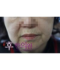 전후사진