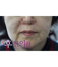 전후사진