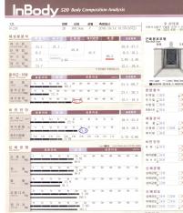 전후사진