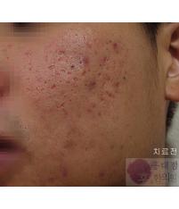 전후사진