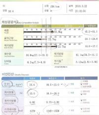 전후사진