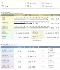 전후사진