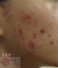전후사진