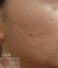 전후사진
