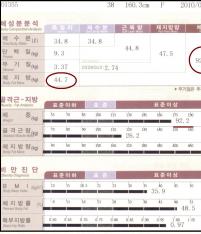 전후사진