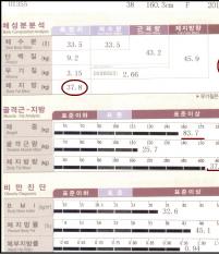전후사진
