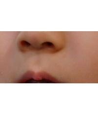 전후사진