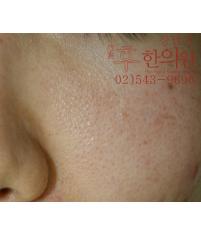전후사진