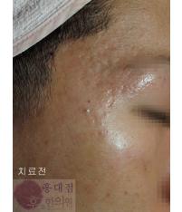 전후사진