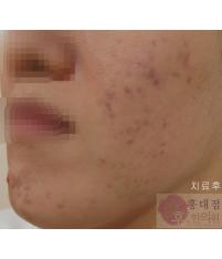 전후사진
