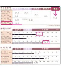 치료 전