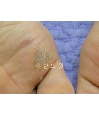 전후사진