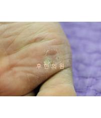 전후사진