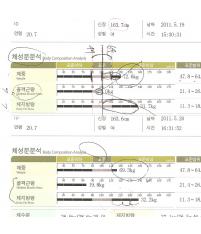 전후사진