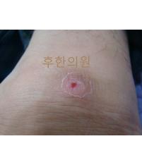 전후사진