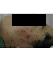 전후사진