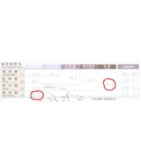 전후사진
