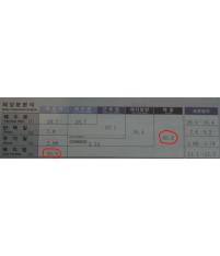 전후사진
