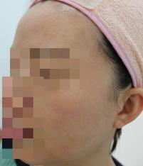 전후사진