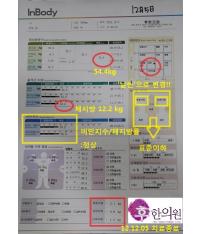 전후사진