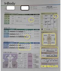 전후사진