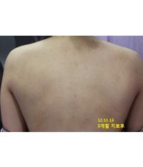 전후사진