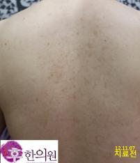 전후사진