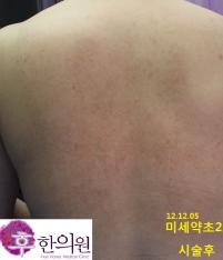 전후사진