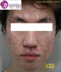 전후사진
