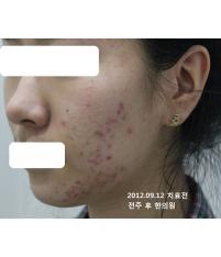 전후사진
