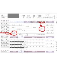 전후사진