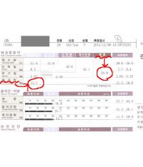 전후사진