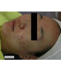 전후사진